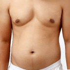 Increased body fat male